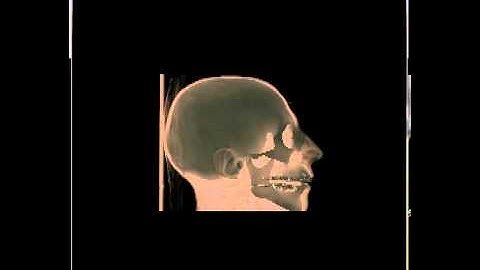 Volume Rendering visible human head