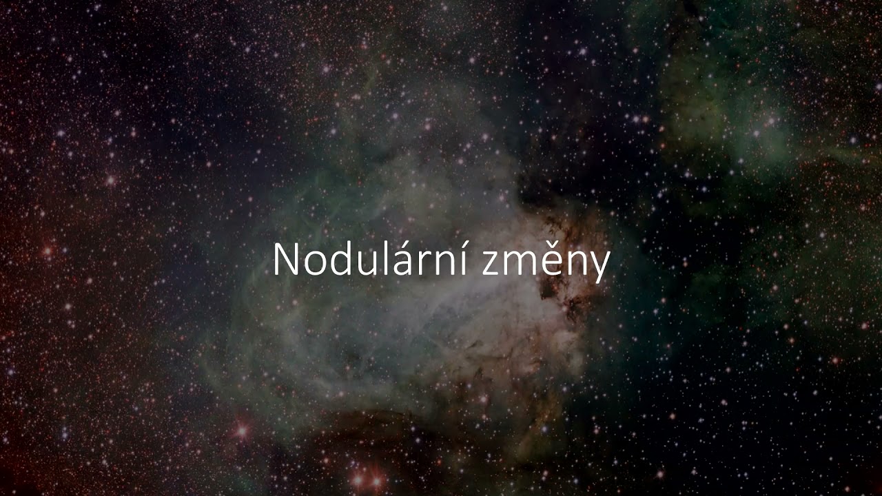 Zobrazení intersticiálních plicních procesů pomocí výpočetní tomografie