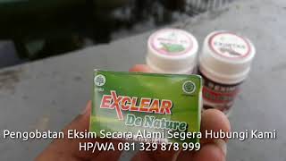 salep eksim basah di apotik