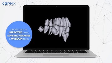 CephX by ORCA Dental AI  |  AI-Driven Automated Dental Services