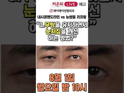 [비온뒤] 무쌍을 유지하면서 눈처짐을 개선하는 방법? 생방송 예고 - 제이제이성형외과 #shorts