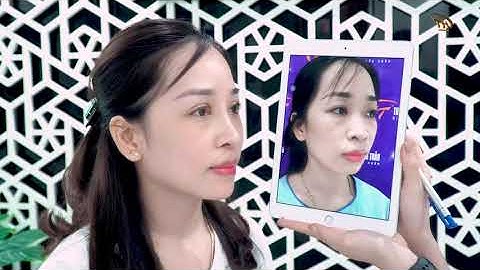 Combo 3 Dịch Vụ Nâng Mũi, Cắt Mí và Độn Cằm | Dr Hoàng Tuấn