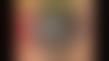 OSSN surgical management