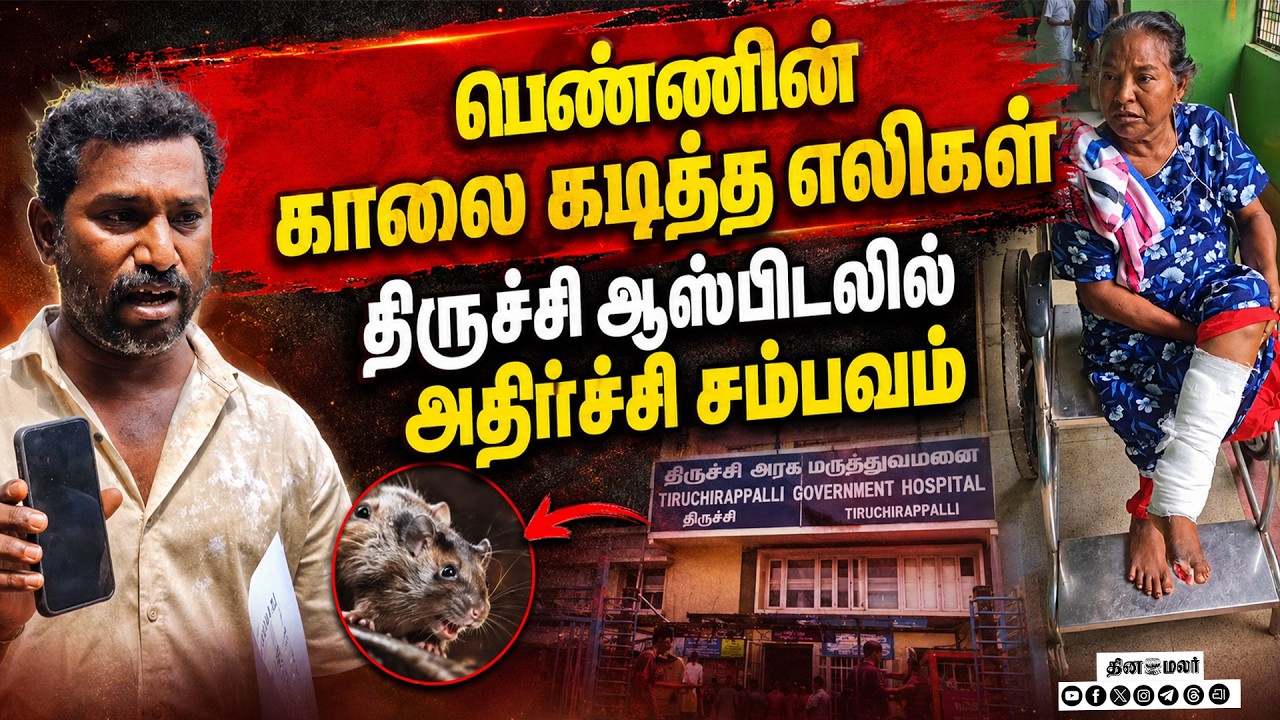 பெண்ணின் காலை கடித்த எலி திருச்சி ஆஸ்பிடலில் பரபரப்புwoman admitted rat bite on toe foot tiruchi