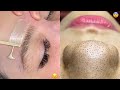 Most Extreme Beauty Treatments 2024 Best Smart and Helpful Beauty Hacks | Virtual Beauty