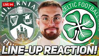 CAN CELTIC - literally - WEATHER A STORM | Hibs vs Celtic | LIVE MATCH PREVIEW!