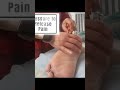 Ankle/Heel pain treatment.