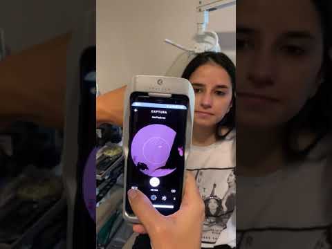 Dra Juliana Barbi Tells Us What Are The Advantages Of The Eyer 