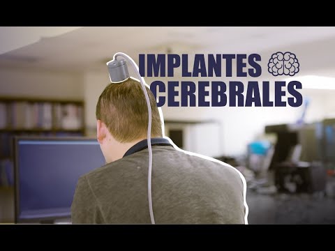¿Qué hay detrás de los implantes cerebrales?