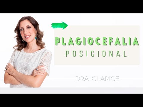 Plagiocefalia posicional