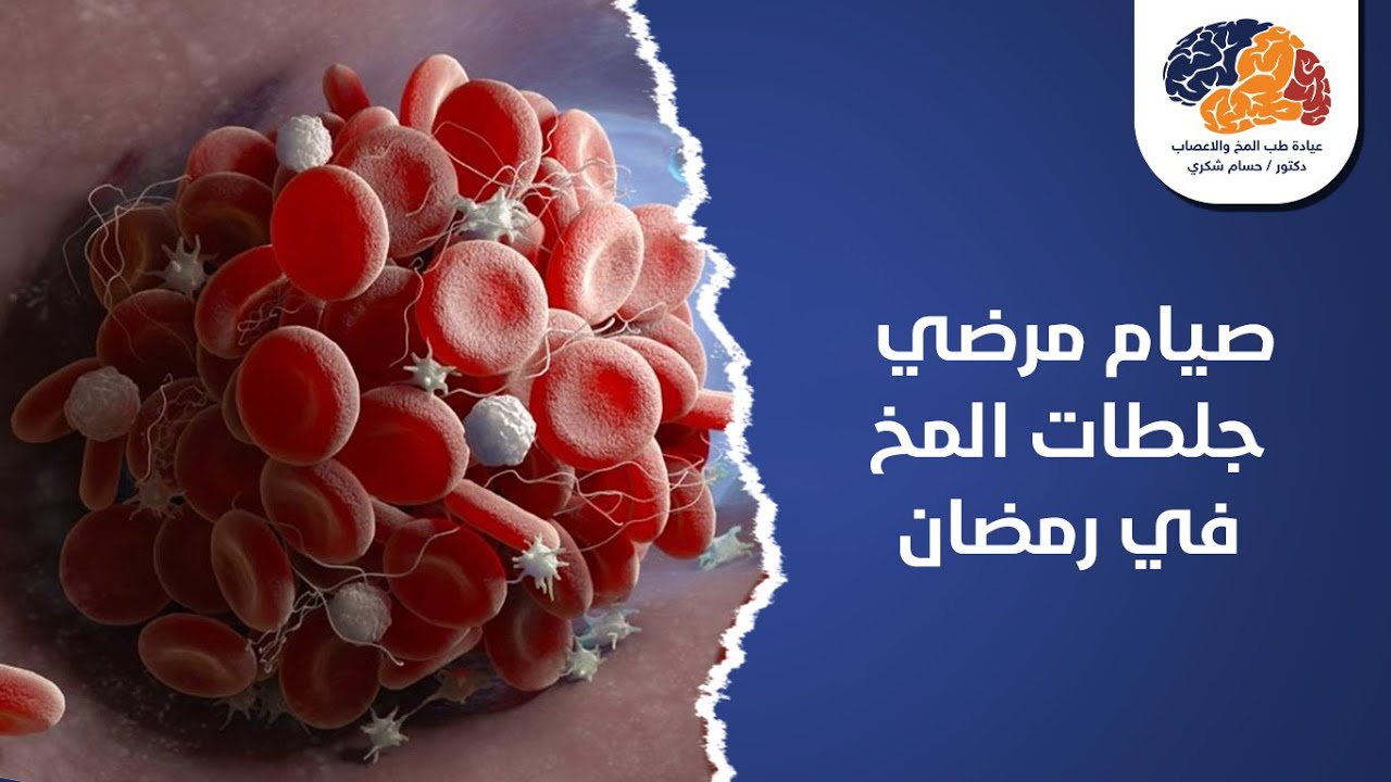 صيام مرضي جلطات المخ في رمضان