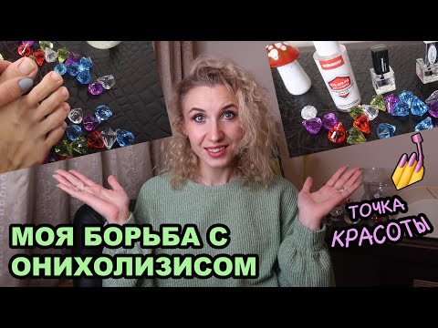 Онихолизис (Отслоение ногтей)💅Причины появления🎱Удалось ли мне справиться с  онихолизисом?