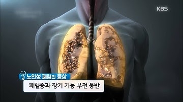 [174회] 감기와 폐렴은 어떻게 다를까?