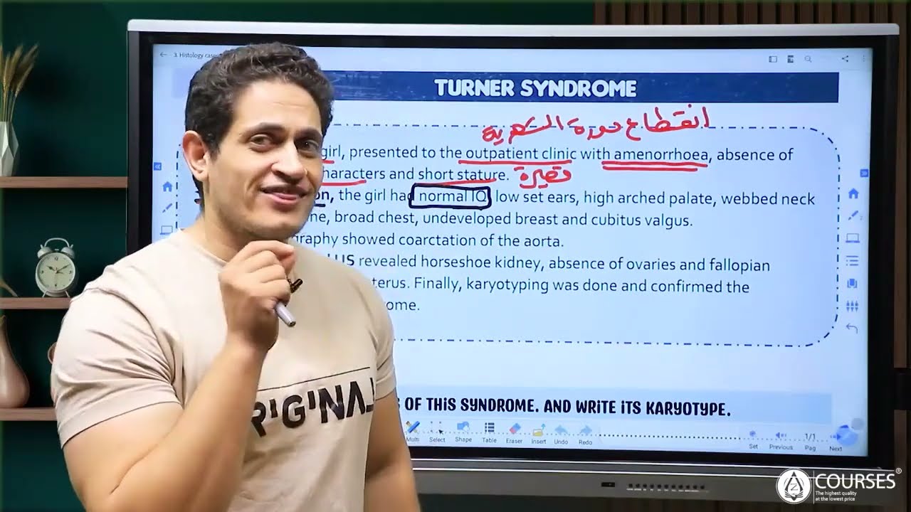 Online Case (3) - Turner Syndrome