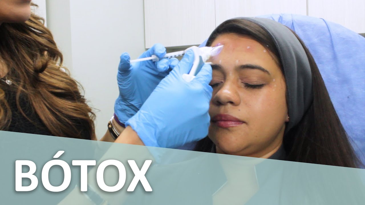 Aplicación de BÓTOX  💉