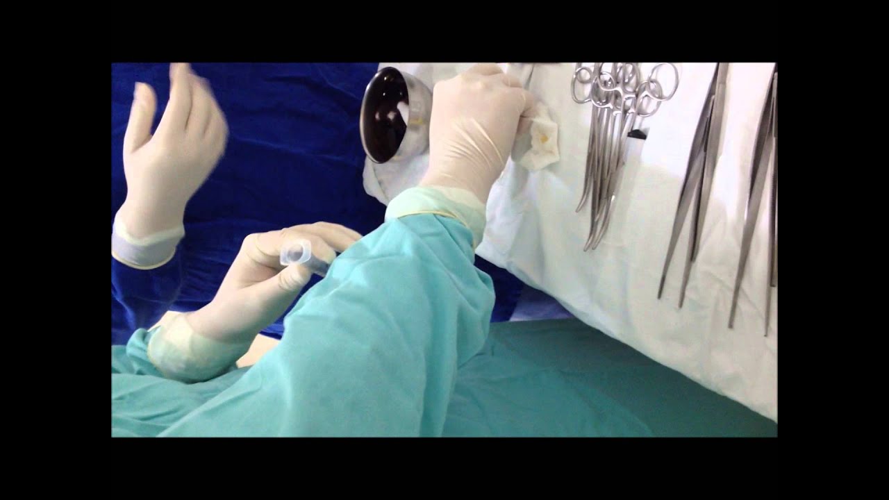 Instrumentação Centro Obstétrico - Parto Cesária