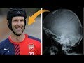 La Historia del Casco Petr Cech