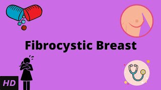 Fibrocystic Breast, Causes, Signs and Symptoms, Diagnosis and Treatment.