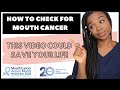 Oral Cancer Screening From Home  | The Warning Signs Of Mouth Cancer