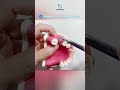 How to implant dental can heal