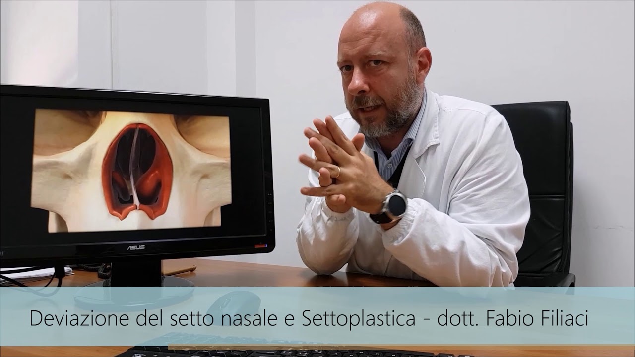 DEVIAZIONE DEL SETTO NASALE E SETTOPLASTICA come e perchè fare l'intervento YouTube DEVIAZIONE DEL SETTO NASALE E SETTOPLASTICA come e perchè fare l'intervento YouTube