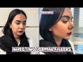Non-Surgical Chin Augmentation | Amazing Before and After