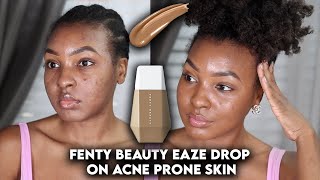 Fenty Beauty Eaze Drop Blurred Skin Tint On Acne Prone Textured Skin Demo Review Kensthetic Youtube Fenty Beauty Eaze Drop Blurred Skin Tint On Acne Prone Textured Skin Demo Review Kensthetic Youtube