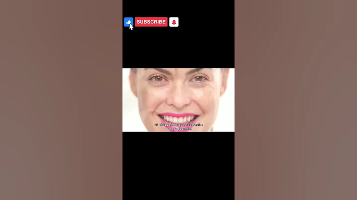 How to care face skin. | Life cell company #beautiful #health @BodyHealthCare-ix6mb