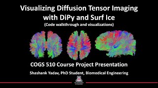 Visualizing Diffusion Tensor Imaging with DiPy and Surf Ice (Code walkthrough and visualizations)