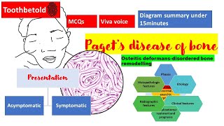 Paget's disease of bone | Radiograph,HISTOPATHOLOGY,clinical features | NBDE,NEET MDS,BDS | Diagrams