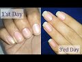 Grow Nails just in 3 Days [ Faster Growth ] | How to Grow Nails Fast || Faster Nail Growth Remedy ||