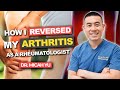 How i reversed my arthritis naturally as a rheumatologist