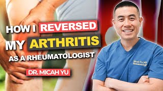 How I REVERSED my ARTHRITIS NATURALLY as a Rheumatologist