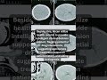 Use of AI for Automating Health Records - Anubrain | Artificial Intelligence | Machine Learning