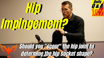 Q & A for The 16% - Hip Impingement? Should you do a "hip scour" to determine hip joint shape?