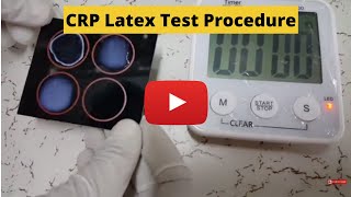 C-Reactive Protein Test (CRP) Latex Test Procedure