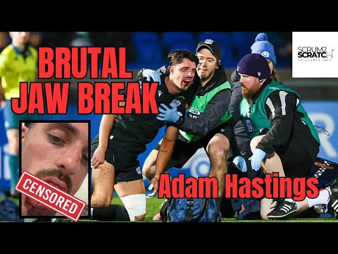Adam Hasting - Brutal Jaw Break in Rugby