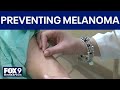 Skin cancer awareness month: Protecting yourself from sun rays