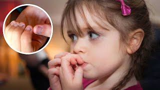 Si tus hijos se muerden las #uñas este video es para ti #adrianabriseño