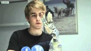 Amputee Patrick demonstrates his world's first bionic hand   BBC   YouTube