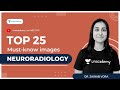 Top 25 must-know images | Neuroradiology | Dr. Zainab Vora