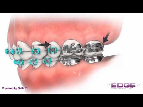 Edge Animations Pokey Wire Demo