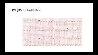 Basic ECG & Introduction to Arrythmias (2/2) Dr Mohamad Maghawry