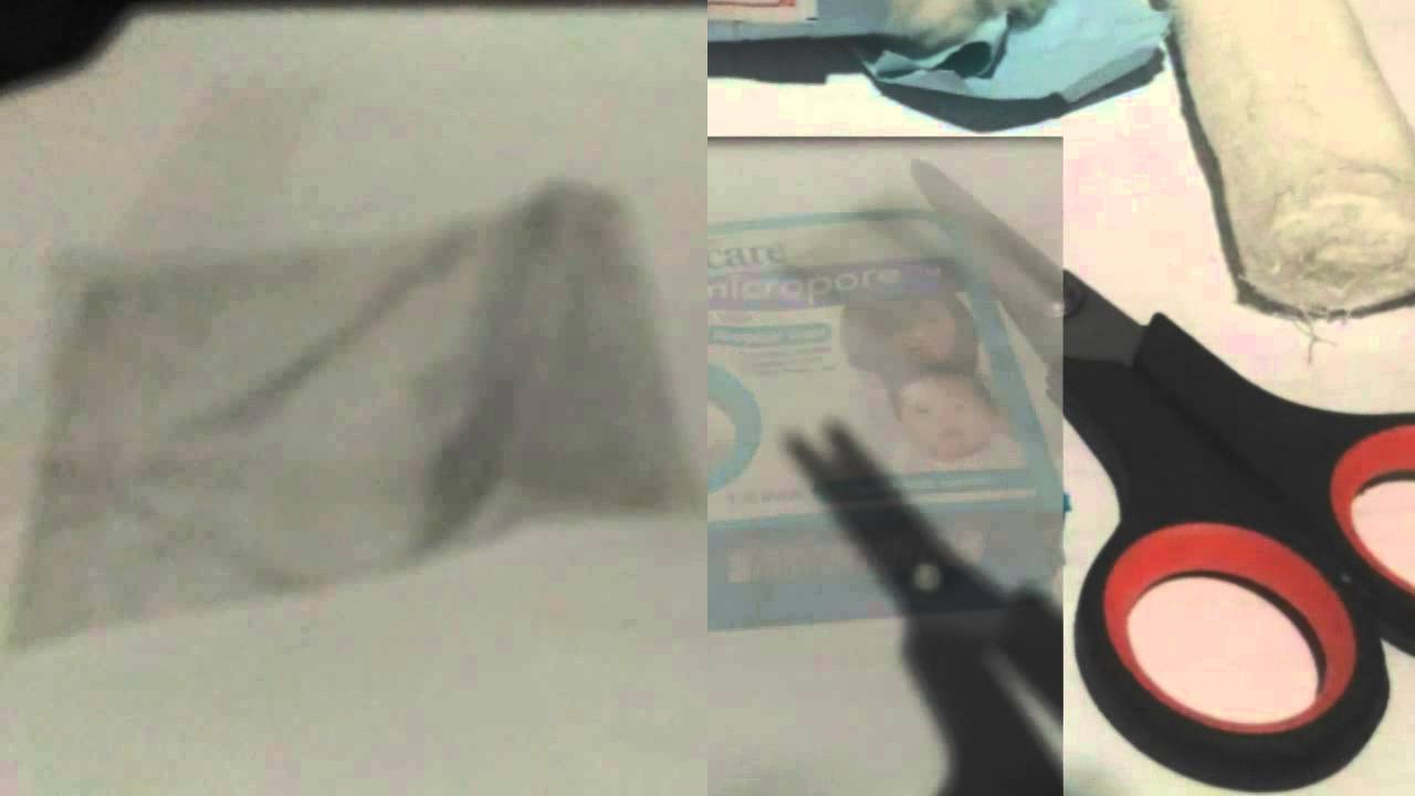 Membuat colostomy bag sendiri YouTube