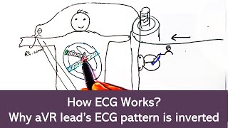 How ECG works? Why ECG pattern of aVR Lead is inverted? How ECG works? Why ECG pattern of aVR Lead is inverted?