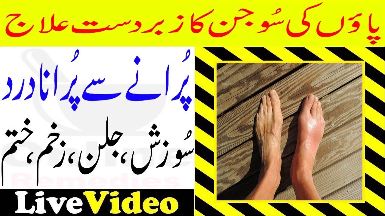 Hath Paon Ka Sun Hona Hath Paon Ka Dard Sozish Jalan Zakham Ka Desi