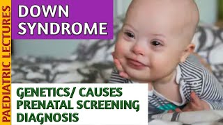 Down Syndrome Genetics, Prenatal & Postnatal Screening screenshot 4