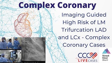 Imaging Guided High Risk of LM Trifurcation LAD and LCx - Complex Coronary Cases - February 19, 2019