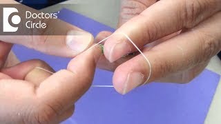 What is Rubber Band Ligation & how is it done? - Dr. Nagaraj B. Puttaswamy