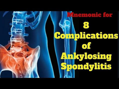 Complications of Ankylosing Spondylitis. Mnemonic
